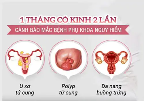Việt Khang Thủ Đức