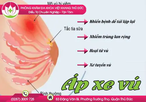 ap-xe-vu-co-nguy-hiem-khong-644
