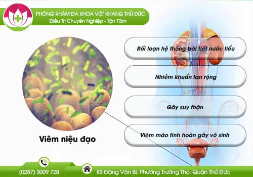 viem-nieu-dao---benh-ly-nam-gioi-khong-nen-xem-nhe-496