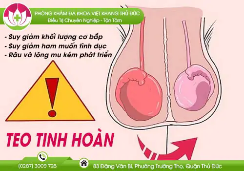 bieu-hien-cua-teo-tinh-hoan-va-cach-chua-tri-hieu-qua-469