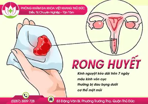 hien-tuong-rong-huyet-va-nhung-dieu-can-biet-353