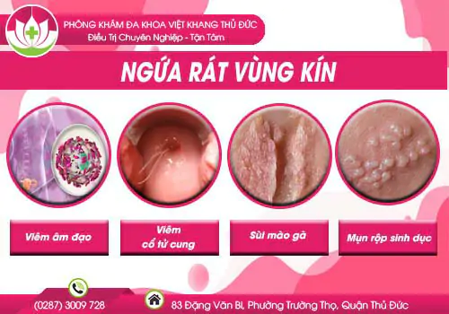 chi-em-can-can-trong-voi-hien-tuong-ngua-rat-vung-kin-334