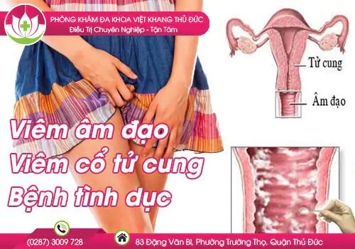 cach-tri-ngua-xung-quanh-vung-kin-hieu-qua-378