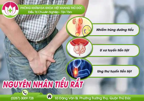 nguyen-nhan-tieu-rat-va-cach-dieu-tri-hieu-qua-546