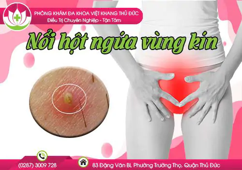 noi-hot-ngua-vung-kin-co-nguy-hiem-khong-canh-bao-benh-gi-582