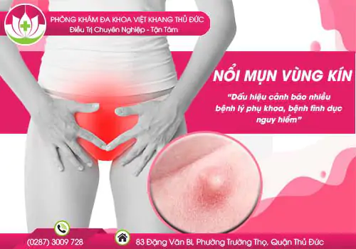 can-than-truoc-nhung-not-mun-dau-vung-kin-nguy-hiem-365