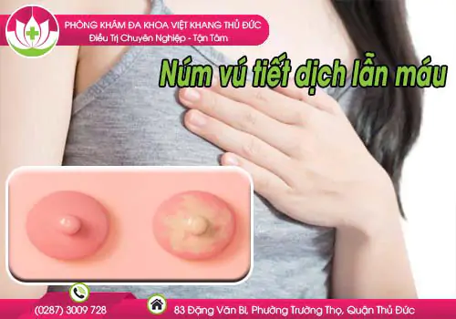 hien-tuong-num-vu-tiet-dich-lan-mau-655