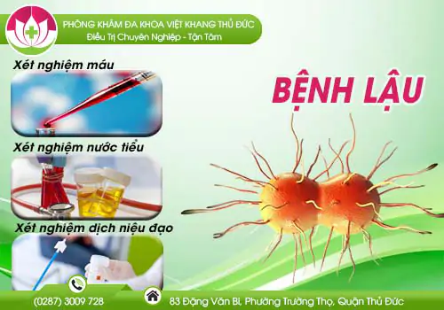 phuong-phap-xet-nghiem-phat-hien-benh-lau-383