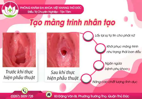 tao-mang-trinh-nhan-tao-nhu-the-nao-420