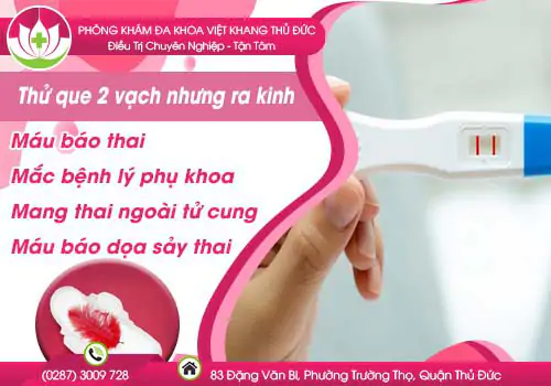 thu-que-2-vach-nhung-ra-kinh-302