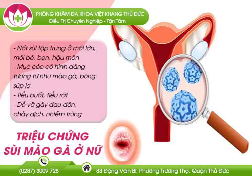 sui-mao-ga-o-nu-trieu-chung-va-cach-ho-tro-dieu-tri-419
