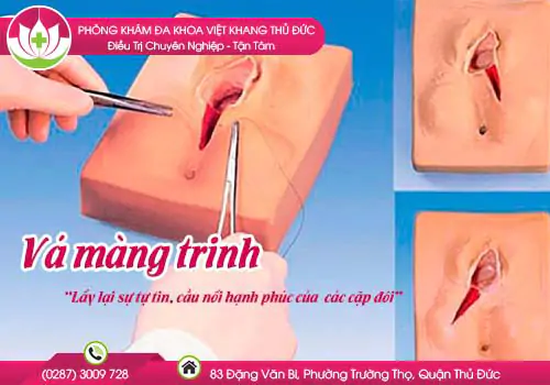 dia-chi-dich-vu-va-mang-trinh-o-dau-hieu-qua-va-bi-mat-tai-hcm-322