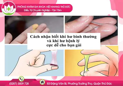 cach-nhan-biet-khi-hu-binh-thuong-va-khi-hu-benh-ly-cuc-de-cho-ban-gai-388