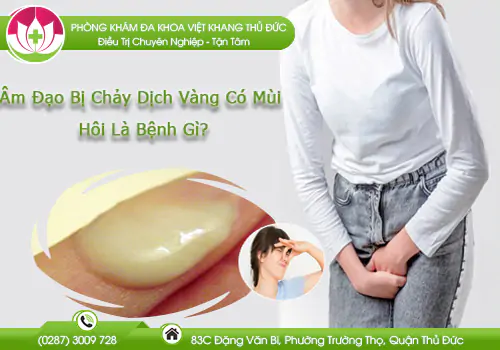 am-dao-bi-chay-dich-vang-co-mui-hoi-la-benh-gi-998