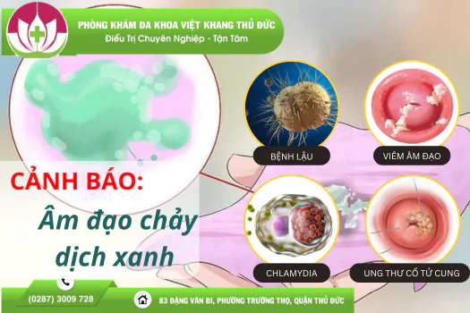 am-dao-chay-dich-xanh-canh-bao-benh-ly-khong-nen-chu-quan-1409