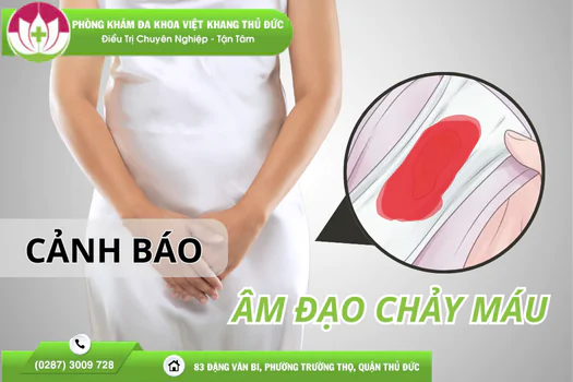 am-dao-chay-mau-bat-thuong-canh-bao-nguy-co-mac-benh-duong-tinh-duc-1414