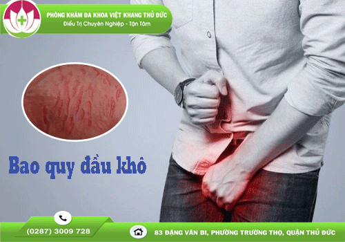 bao-quy-dau-bi-kho-trieu-chung-binh-thuong-hay-benh-ly-tiem-an-1938