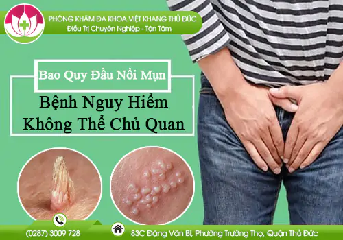 bao-quy-dau-noi-mun-benh-nguy-hiem-khong-the-chu-quan-876