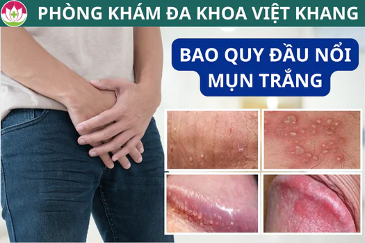 bao-quy-dau-noi-mun-trang-nguyen-nhan-va-cach-loai-bo-mun-nhanh-1271