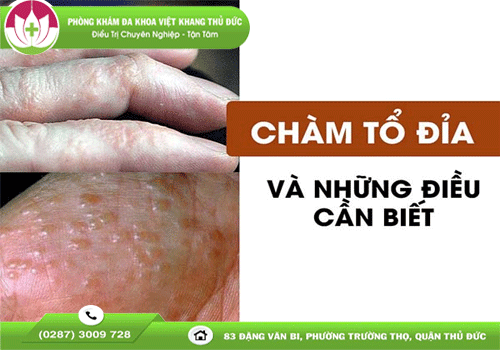 canh-giac-voi-benh-cham-to-dia-1892
