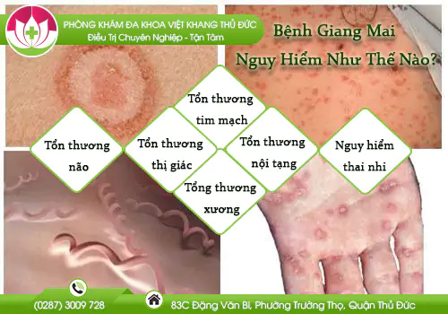 benh-giang-mai-nguy-hiem-nhu-the-nao-dieu-tri-ra-sao-1032