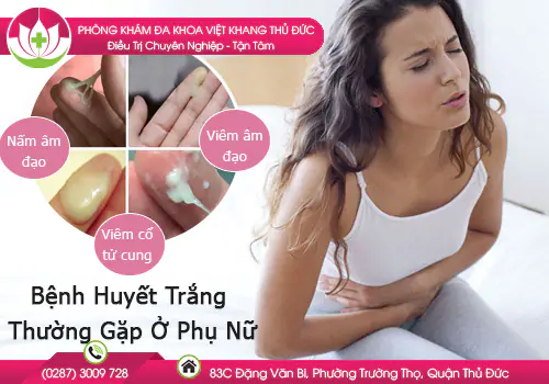 cach-chua-tri-huyet-trang-hieu-qua-an-toan-1512