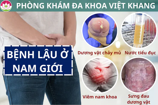 benh-lau-o-nam-gioi-nhan-biet-va-dieu-tri-som-tranh-nguy-co-vo-sinh-1293