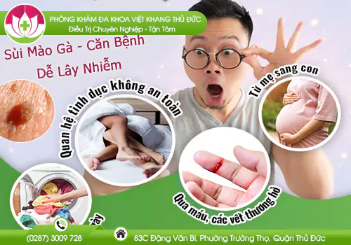 benh-sui-mao-ga-can-benh-de-lay-nhiem-nhung-kho-dieu-tri-916
