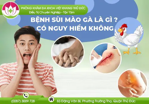benh-sui-mao-ga-la-gi-co-nguy-hiem-khong-697