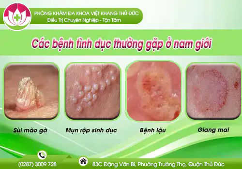 cac-benh-tinh-duc-thuong-gap-o-nam-gioi-244
