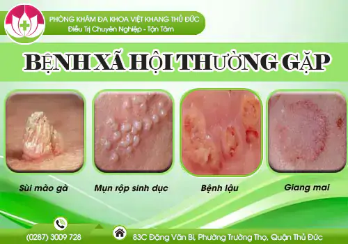 benh-xa-hoi-dia-chi-kham-benh-xa-hoi-an-toan-bao-mat-tai-tphcm-1501