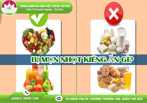 bi-mun-nhot-kieng-an-gi-tranh-de-khong-viem-nang-2049