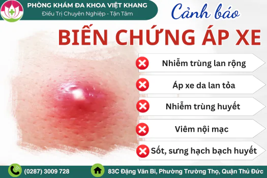 co-nen-tu-tri-ap-xe-tai-nha-hay-khong-1827