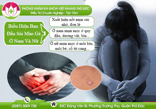 bieu-bien-ban-dau-khi-mac-phai-sui-mao-ga-o-nam-va-nu-gioi-865