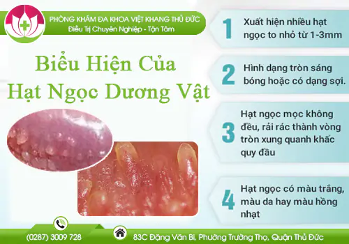 bieu-hien-cua-hat-ngoc-duong-vat-nguyen-nhan-va-phuong-phap-dieu-tri-hieu-qua-877