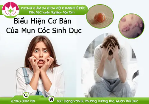 mot-so-bieu-hien-co-ban-cua-mun-coc-sinh-duc-904