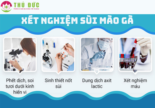 cac-cach-xet-nghiem-sui-mao-ga-khi-nao-can-xet-nghiem-1273