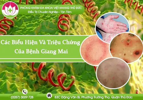 mach-ban-cac-bieu-hien-va-trieu-chung-cua-benh-giang-mai-1042