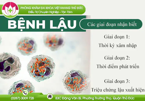 cac-giai-doan-cua-benh-lau-392