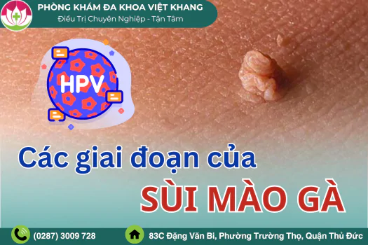 hinh-anh-nhan-biet-cac-giai-doan-cua-sui-mao-ga-1720