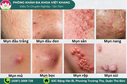 Việt Khang Thủ Đức