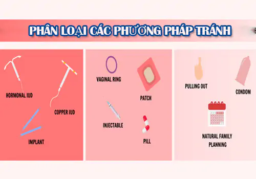 Phân loại các phương pháp tránh thai cần biết