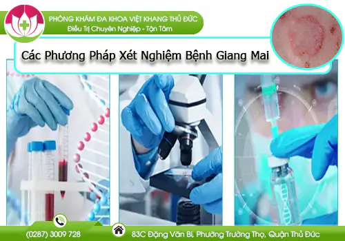 tim-hieu-cac-phuong-phap-xet-nghiem-benh-giang-mai-939