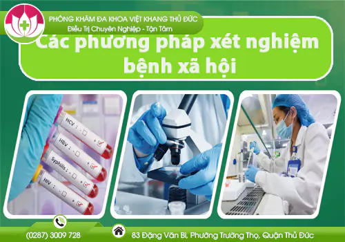 cac-phuong-phap-xet-nghiem-benh-xa-hoi-727