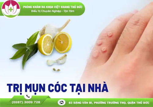cach-dieu-tri-mun-coc-sinh-duc-tai-nha-an-toan-2087