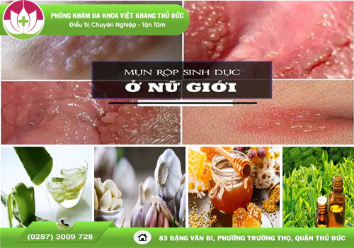 cach-tri-mun-rop-nu-tai-nha-don-gian-an-toan-2183