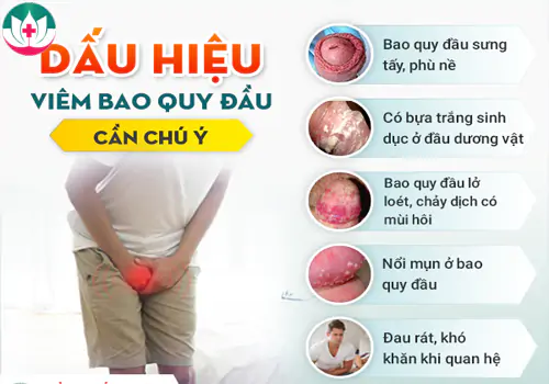 Dấu hiệu viêm bao quy đầu nam giới cần biết