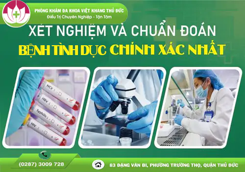 cach-xet-nghiem-benh-tinh-duc-chinh-xac-va-nhanh-tai-tphcm-1330