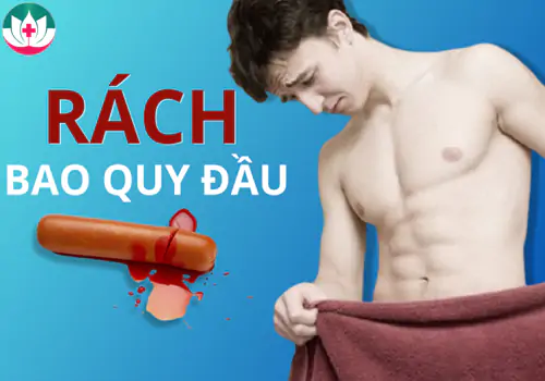 cach-xu-ly-bi-rach-bao-quy-dau-khi-quan-he-an-toan-khong-dau-1198