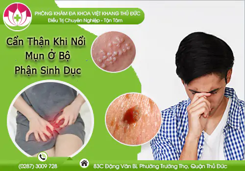 can-than-khi-noi-mun-o-bo-phan-sinh-duc-975